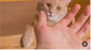 وقاية السعار.. إرشادات المصل المضاد بعد عقر قطة لشريف مدكور